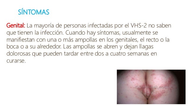 Herpes peniana sintomas fotos 64 Herpes peniana sintomas fotos 4